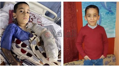 حبس وغرامة وإيقاف موظفين حكوميين تسببوا في تفحم ذراع طفل بالشرقية | صور