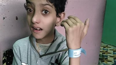 الموافقة على إجراء عملية إصلاح عيب خلقي لطفل بالغربية 