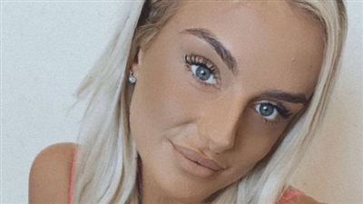 ورم بالأنف وفقدان الأكسجين.. إصابات مؤسفة لفتاة بسبب هوسها بنفخ الشفاه | فيديوجراف