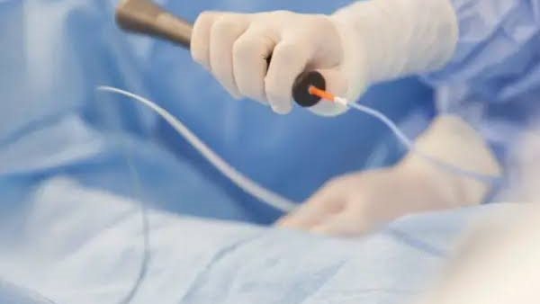 قسطرة القلب-أرشيفية