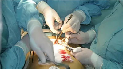 متحدث الصحة: لا وجود لسرقة الأعضاء.. وتجارة الأعضاء قائمة على استغلال الفقراء