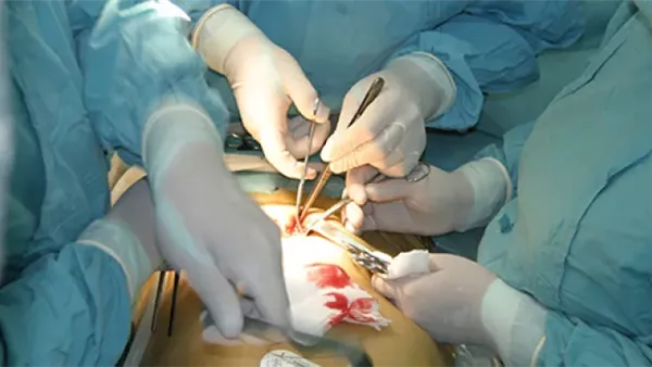 تجارة الأعضاء - تعبيرية