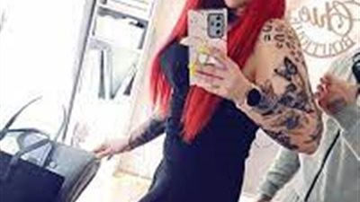 عملية تجميل تتحول لـ كابوس.. سيدة بريطانية تصاب بتشوهات كبيرة بعد إجرائها جراحة لشد البطن 