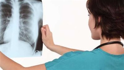 الصحة تعلن انخفاض معدل الإصابة بمرض الدرن في مصر