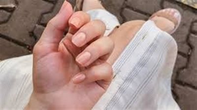 ضعف الأظافر وبطء نموها.. أعراض خفية لقصور الغدة الدرقية