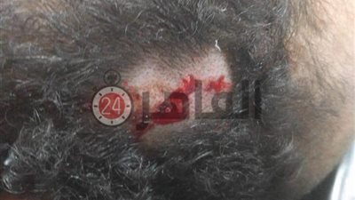 بلاغ ضد أقارب برلماني في المنوفية لتعديهم بالضرب على أطباء في المستشفى (صور)