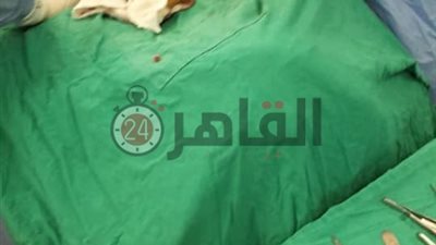 لأول مرة استئصال غضروف بالقطنية لمريض بمستشفى دسوق العام (صور)