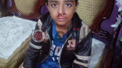 صفعه وسبه بألفاظ خارجة.. والدة تلميذ من ذوي الاحتياجات الخاصة تروي تفاصيل اعتداء معلم على ابنها