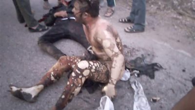 إصابة 4 أشخاص بحروق إثر اصطدام دراجتين بخاريتين في الدقهلية