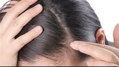 6 نصائح فعالة لتحفيز نمو الشعر