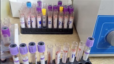 غلق وتشميع 7 منشآت طبية خاصة دون ترخيص بالبحيرة