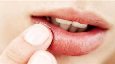 احذري الخروع ومعجون الأسنان.. يسبب حساسية الشفايف في فصل الصيف 