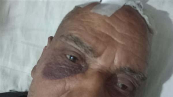 إصابة مسن ونجله في