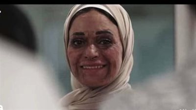 هتبرع إزاي لما أشوف وشها.. بلاغ ضد المتهم بالتنمر على بطلة إعلان مستشفى علاج الحروق 
