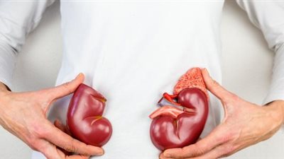 أطعمة مناسبة لمريض الكلى.. تعرف عليها