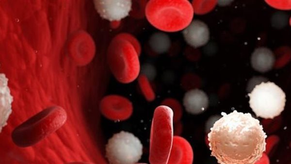 فرط كالسيوم الدم