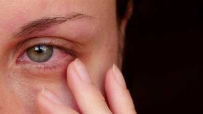 منها الخيار والبيض.. 8 طرق لعلاج التهابات العين في المنزل