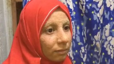 بث مباشر| بعد معاناة المرض لسنوات.. الفتاة فاتن تستغيث بـ هاني الناظر: عالجني يا دكتور قبل ما حالتي تتدهور