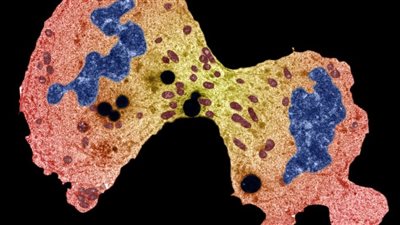 بعد تحليل ضخم للحمض النووي..علماء يكتشفون أدلة جديدة تساعد في تشخيص وعلاج السرطان 