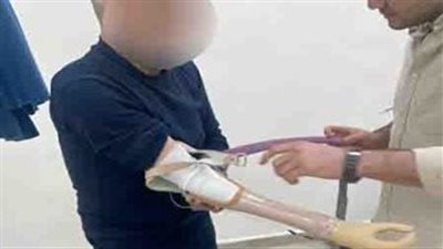 الداخلية: تركيب أطراف صناعية لنزلاء بمنطقة مراكز إصلاح وتأهيل بدر