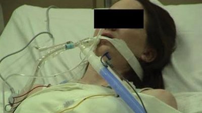 إحداهن في العناية المركزة.. تفاصيل الحالة الصحية لـ3 عاملات دهستهن طبيبة ببني سويف