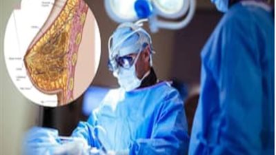 اختلالات هرمونية وراء إصابة سيدة إماراتية بورم في الثدي بوزن 2.7 كجم