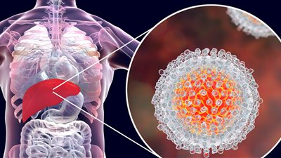 الصحة البريطانية: من المتوقع القضاء على التهاب الكبد الوبائي خلال 3 سنوات