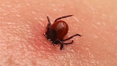 فشل خبراء الصحة في اكتشاف العلامات المبكرة لمرض لايم
