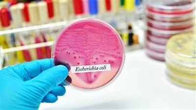 تصيب أكثر من مليون بريطاني سنويا.. اكتشاف لقاح ضد بكتيريا التهاب المسالك البولية 