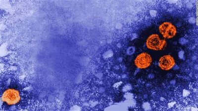 بعد وفاة 3 أطفال بالتهاب الكبد الحاد.. إندونيسيا تعلن ظهور 15 حالة إصابة جديدة