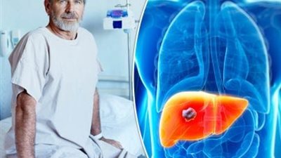 هل هناك ارتباط بين آلام القدم والإصابة بمرض الكبد؟