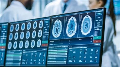 مريض يحذر من مركز مصر للأشعة.. ويزعم: عملولي رنين في دقايق وادوني تقرير مضلل