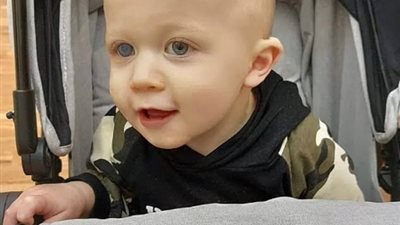 طفل عمره سنة يزيل عينيه.. بعد الإصابة بورم الأورمي الشبكي