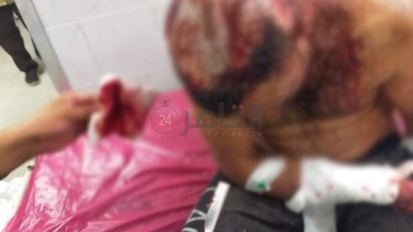 شاب إمبابة المجني