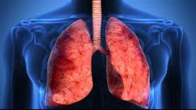 5 عوامل تزيد من خطر الإصابة بـ أمراض الرئة.. تعرف عليها 