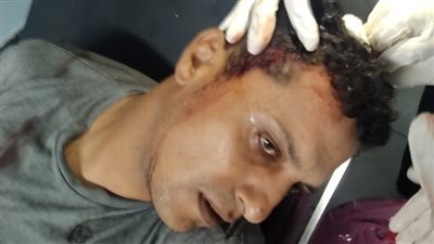 بعد حادث سرقة المنزل في رمضان..هجوم بالأسلحة البيضاء والشوم على منزل عائلة إمام بالدقهلية