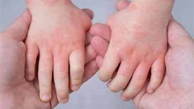 أول تعليق من الزراعة على استيراد الخضروات من الهند بعد ظهور فيروس إنفلونزا الطماطم بها