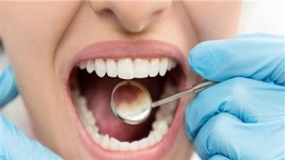 تسبب في نزيف وعاهة مستديمة لمريضة.. كواليس حبس طبيب أسنان شهير بالعجوزة