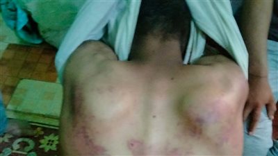 حفلة تعذيب بالكرباج.. القبض على متهم بحجز عمال وضربهم بالعبور