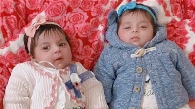 توأم في فك المرض.. أب يستغيث لعلاج طفلتيه المصابتين بالضمور العضلي الشوكي