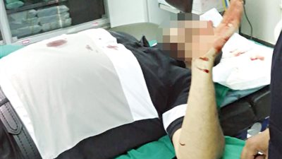 ارتجاج بالمخ وكسر بعظام العين.. مريض يعتدي على طبيب بمستشفى أم المصريين العام