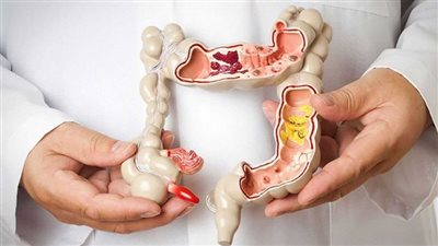 علاج القولون بطرق طبيعية في المنزل.. احذر ظهور 7 أعراض خطرة