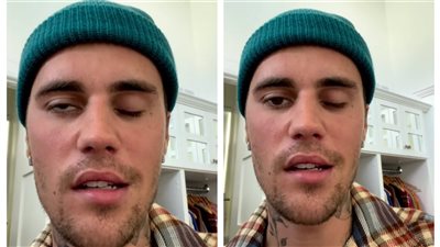 جاستن بيبر يعلن إصابته بشلل في الوجه: أثق بالله ولدي أمل | فيديو 