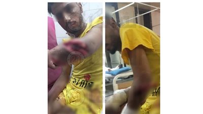 عشان عمل خير.. إصابة شاب في مشاجرة بروض الفرج | صور 