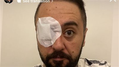 عمرو عبد العزيز: عملت عملية في عيني ولسة 3 مرات كمان | صورة