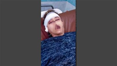 مبتسمعش الكلام.. عامل يقطع أذن زوجته ويسدد لها 20 طعنة بحلوان