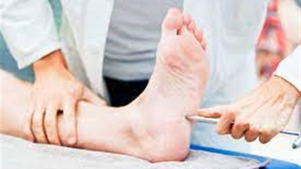 اعتلال الأعصاب