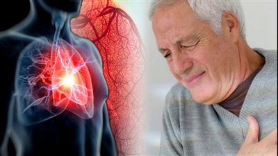 النشاط البدني والتدخين.. 6 علامات تشير للإصابة بنوبة قلبية مفاجئة