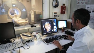 علماء يطورون نظاما جديدا لاكتشاف مرض الزهايمر مبكرًا