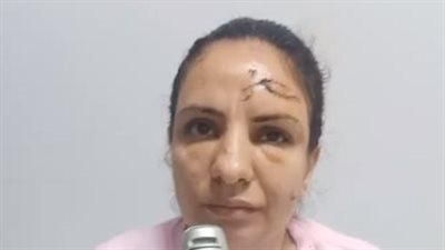 رجل يعتدي على شقيقة زوجته بالوراق.. والضحية: قطع شرايين إيدي بالمطواة عشان بودي بنته الحضانة | بث مباشر